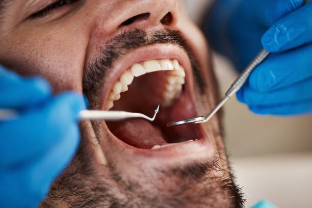 Best Emergency Dentist for Knocked-Out Tooth in Holliday, TX