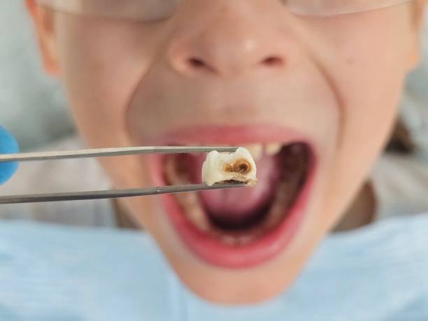 Best Emergency Dental Services for Seniors in Holliday, TX